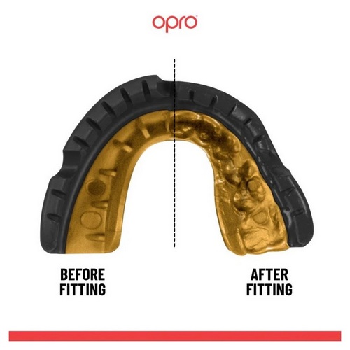 OPRO OCHRANIACZ SZCZĘKI NA APARAT GOLD BRACES - BLACK